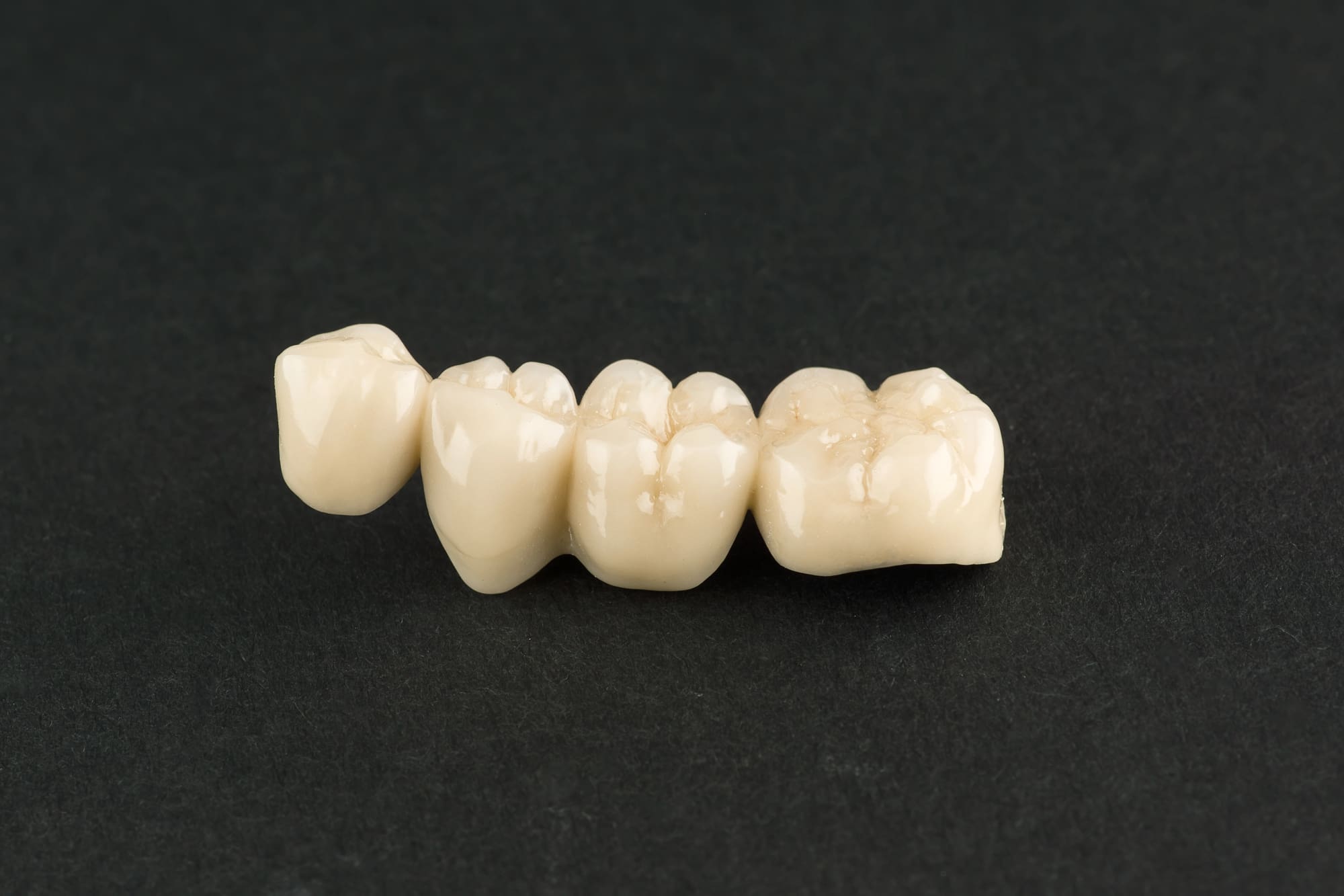 Dental Bridge vs Partial Denture: Which One is Right for You?