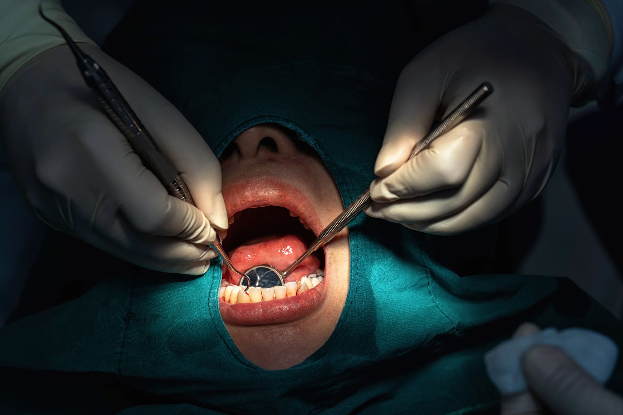 How to Clean a Dental Bridge Properly: Step-by-Step Maintenance Guide