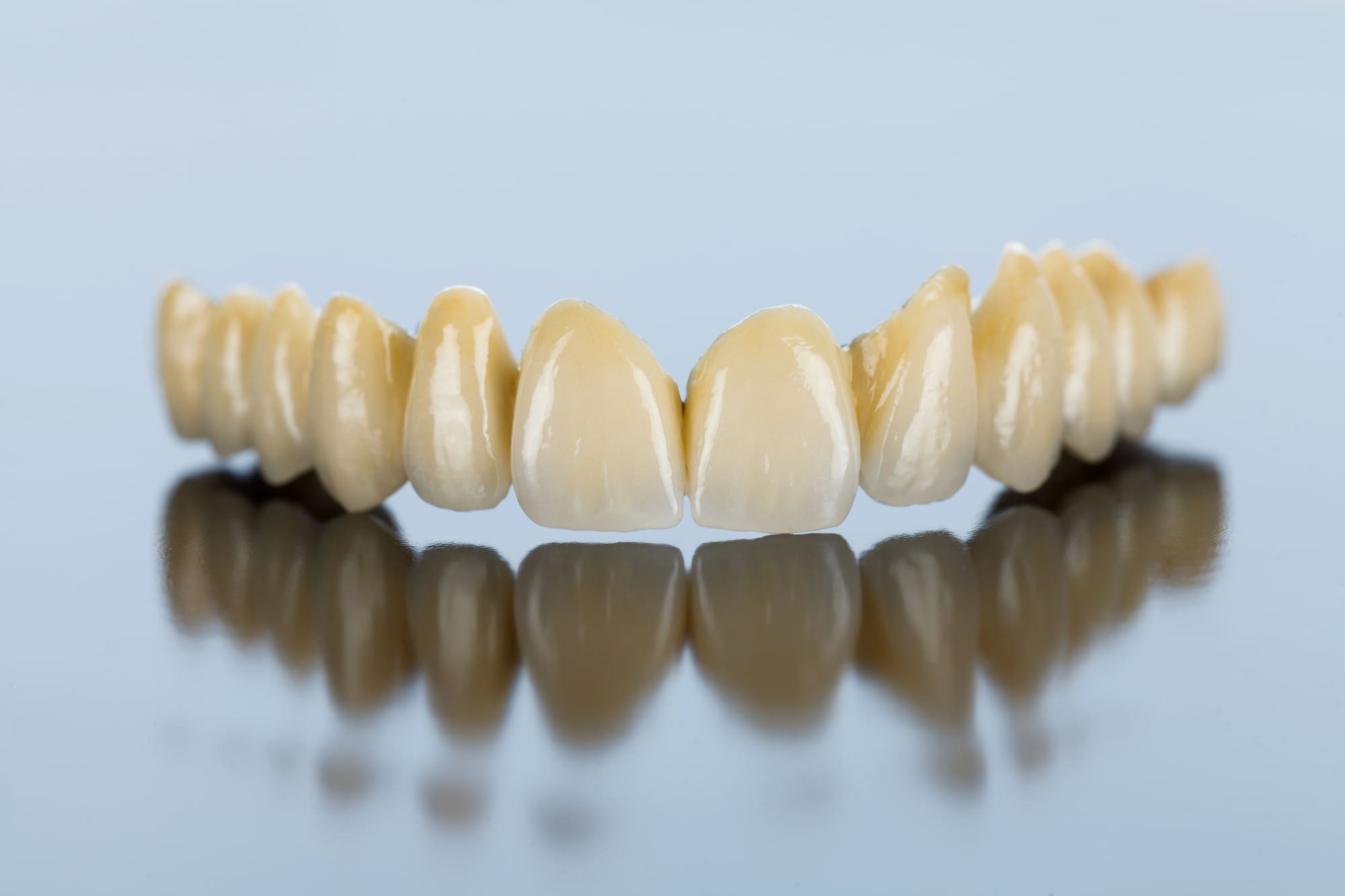 Alternatives to Dental Bridges: Exploring the Best Options for Replacing Missing Teeth