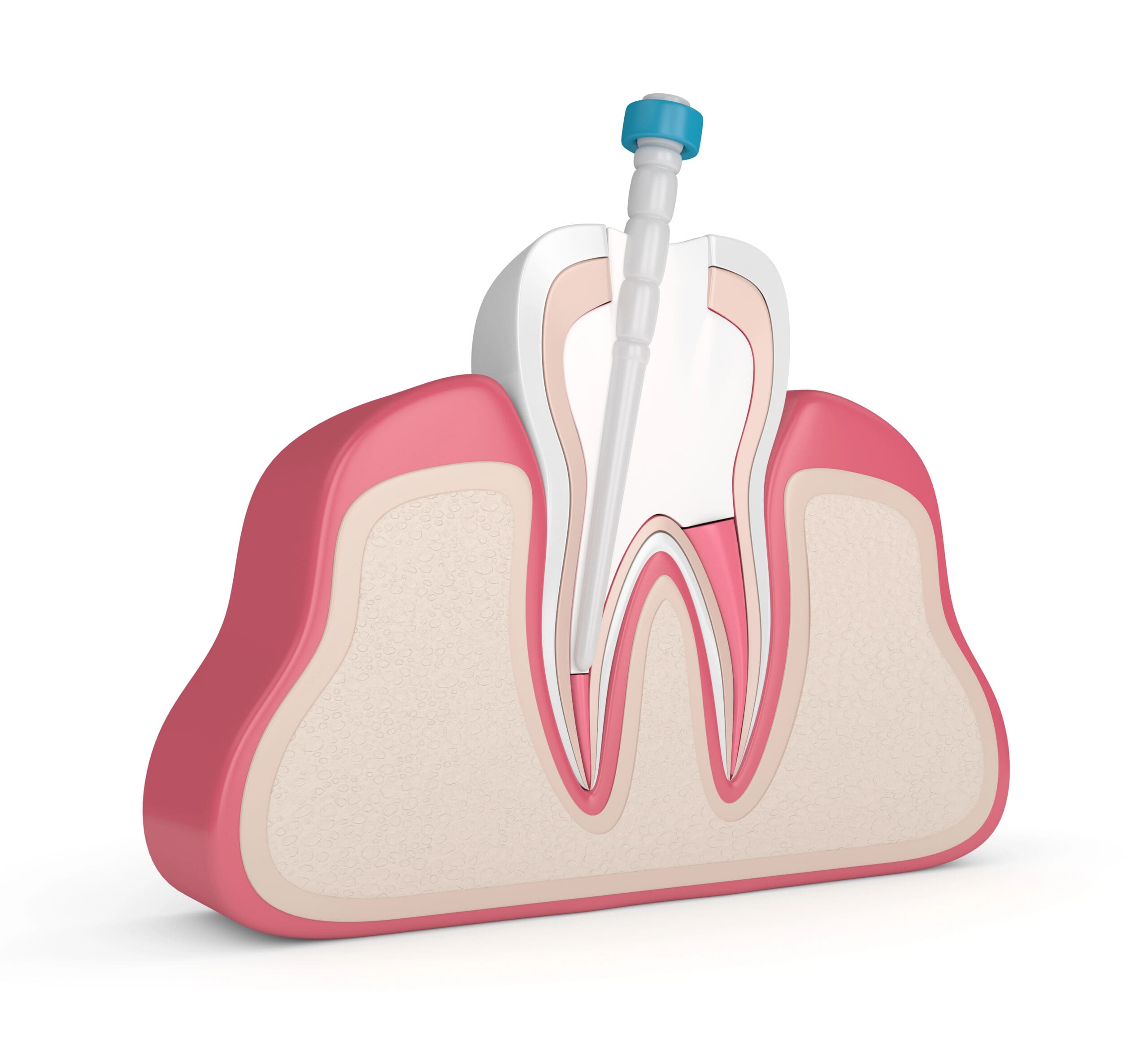 Emergency Periodontal Gum Treatment: Fast Action to Save Your Smile