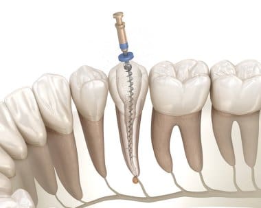 Periodontal Gum Disease Without Surgery: Non-Invasive Options That Work