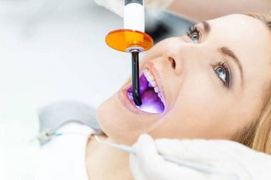 Dental Sealants Without Fluoride: A Natural Approach to Prevention