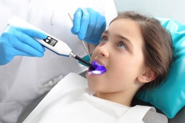 Dental Sealants with Painless Application: Easy Prevention, Zero Discomfort